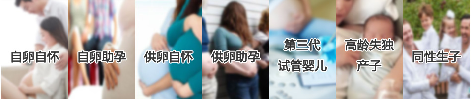 服务项目