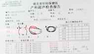 孕期检查