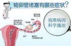 输卵管不通的话，广州代妈的身体会有那些信号