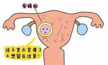 卵巢早衰可以做试管婴儿吗？