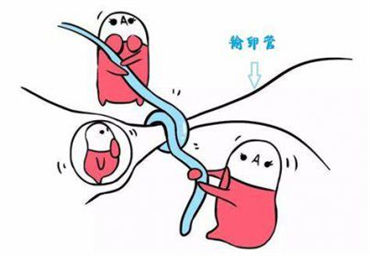 输卵管阻塞是复通还是做试管婴儿？