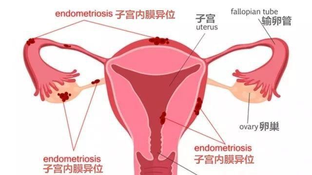 试管婴儿三代技术各有其适用范围,并不是越高越好