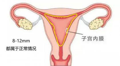 内膜异常怎么办？