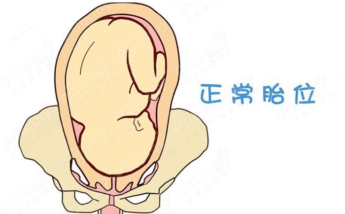 孕32周胎位不正的纠正方法