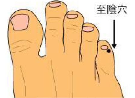 孕32周胎位不正的纠正方法