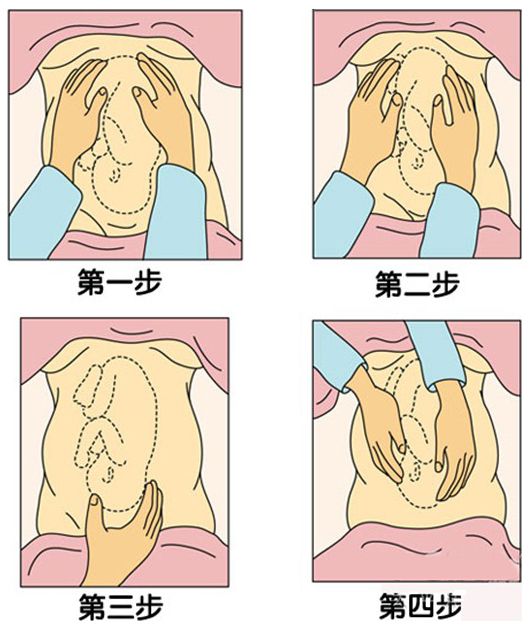 孕32周胎位不正的纠正方法