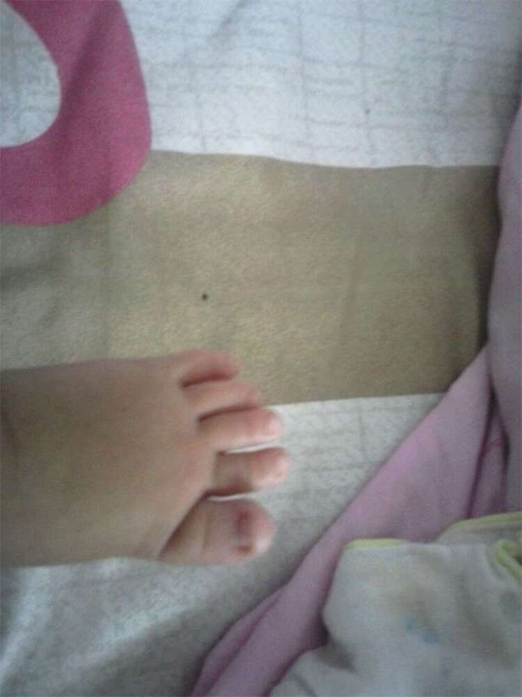 孕吐不适怎么办?