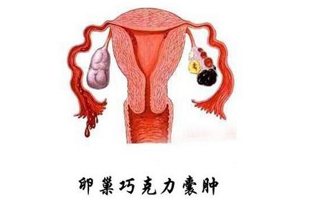 试管婴儿双胞胎几率高吗?