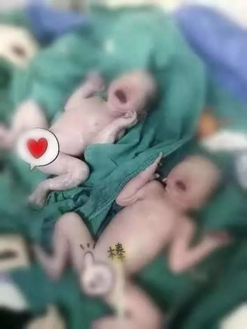 黄体功能不足要怎么调理
