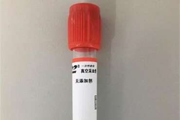 常见的试管婴儿失败的原因有哪些