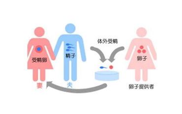 了解卵泡发育不良引起的不孕不育