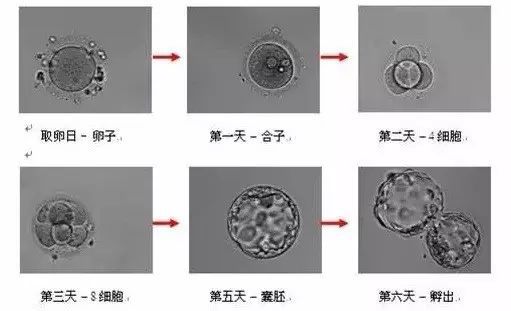 广州试管婴儿助孕中,胚胎在实验室的发育全过程详解