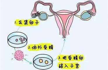 为什么要先降调才能开始促排卵