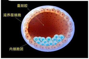 试管婴儿要做宫腔镜检查吗？
