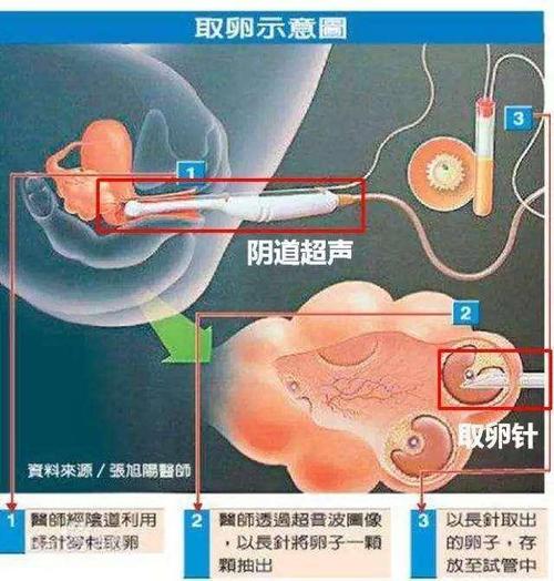代妈贫血的症状有哪些