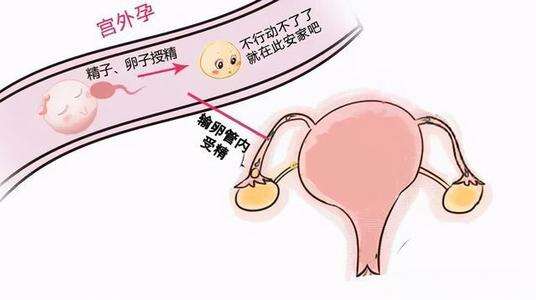 胚胎质量可以为什么会失败?