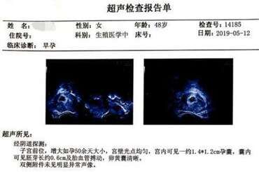 为了你的卵子这些不要做
