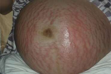 备孕饮食需谨慎