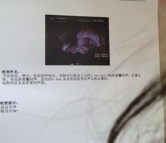 一旦出现不孕做哪些相关检查