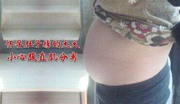 怀孕肚子撑的太大，小心腹直肌分离