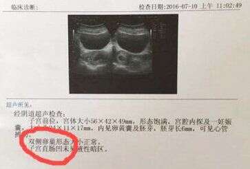 广州耿哥公司教你怎么看广州助孕期间B超单