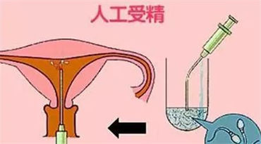 哪些小诀窍能增加受孕几率