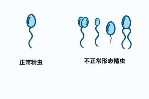 试管婴儿移植后,以下事项要注意
