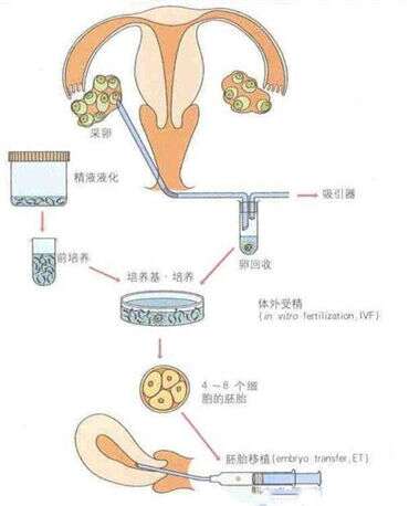 出现不排卵性不孕要怎么办？