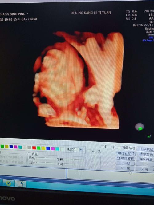 为什么建议高龄代妈做广州助孕