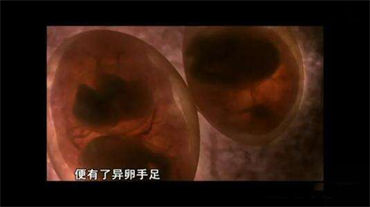 代妈卵巢早衰可能跟这3个因素有关