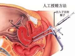 人工授精和试管婴儿有什么区别