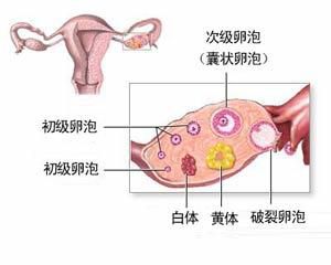 如何通过阴道超声监测排卵