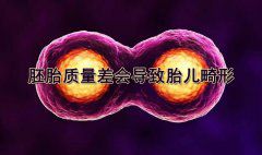 试管婴儿中胚胎质量差会导致胎儿畸形吗？