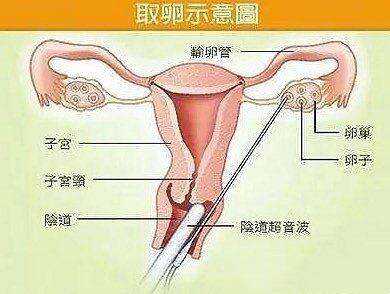 什么样的人易患甲状腺疾病