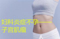 妇科炎症不孕—子宫肌瘤