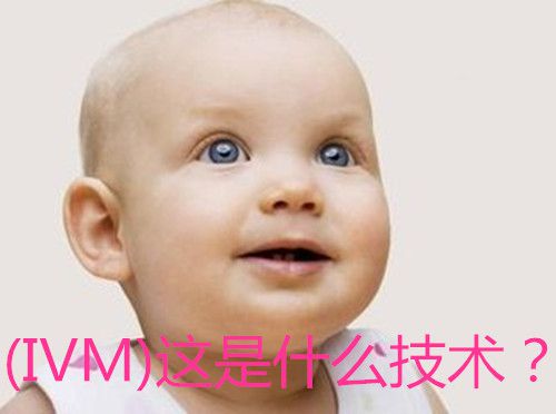 (IVM)这是什么技术?