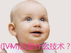 （IVM）这是什么技术？