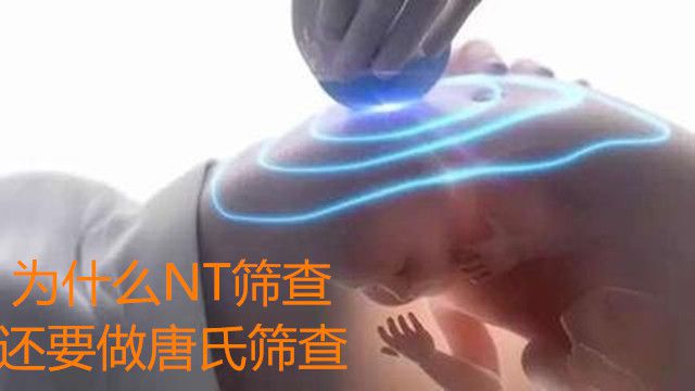 为什么NT筛查还要做唐氏筛查