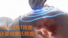 为什么NT筛查还要做唐氏筛查