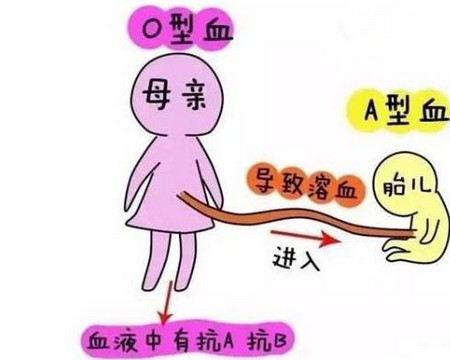 如何预防排卵异常现象