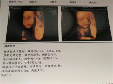 卵巢炎不孕该如何调理