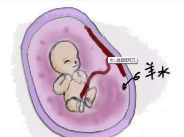 广州代妈羊水过多如何护理？