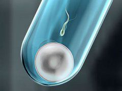 广州第一代试管婴儿（IVF-ET）
