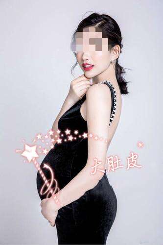 90后代妈为何更容易患不孕