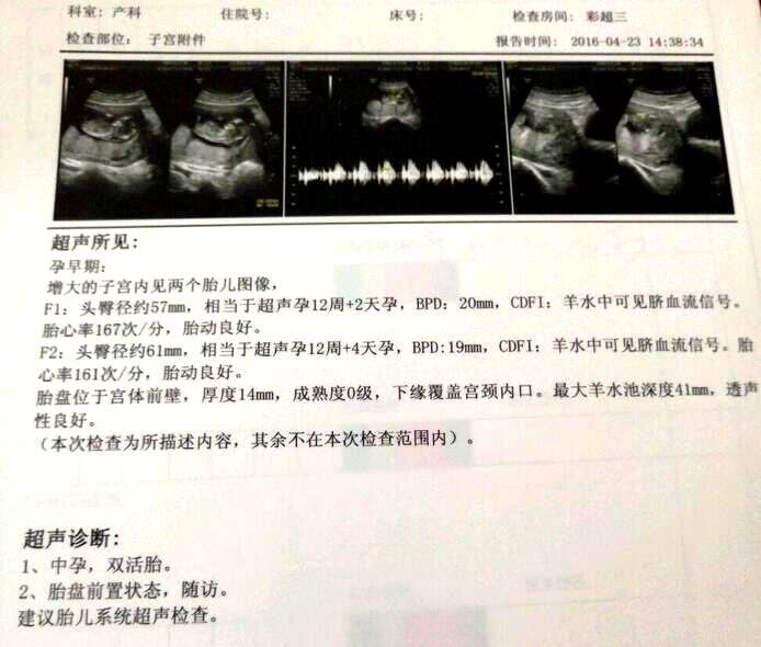 nt检查是什么