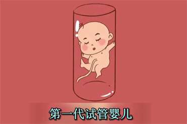 第一代试管婴儿（IVF）