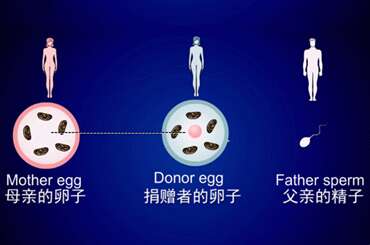 第四代试管婴儿
