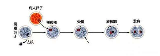 第四代试管婴儿