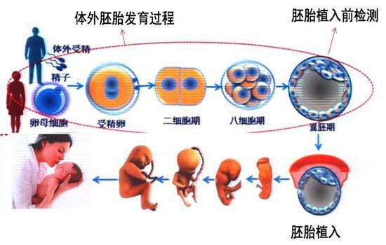 第三代试管婴儿（PGD）