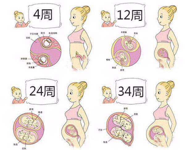 双胞胎